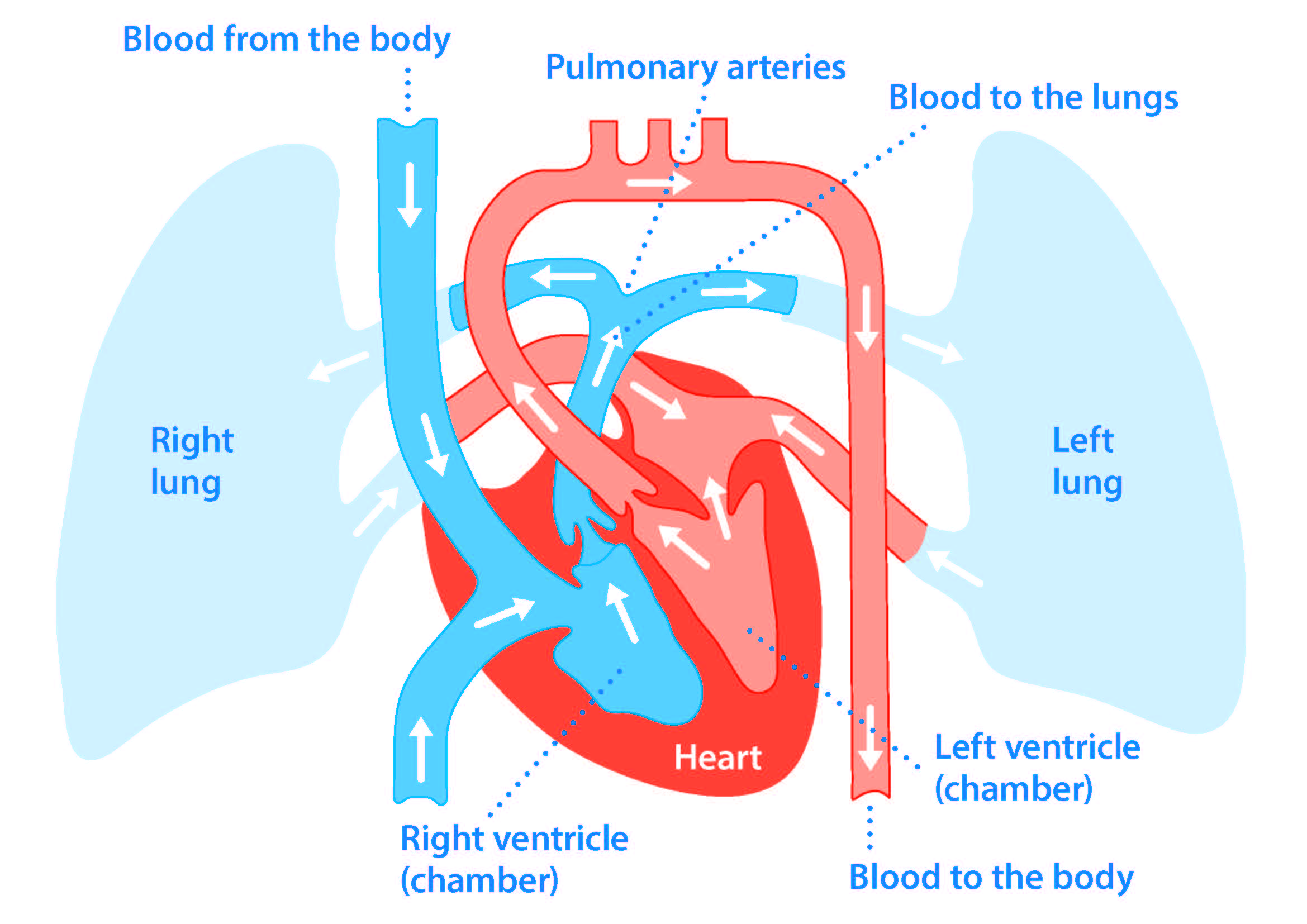 Pulmonary on sale hypertension causes